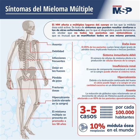 mieloma multiple sintomas en español.